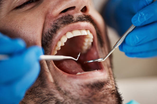 Best Full Mouth Reconstruction  in East Sandwich, MA